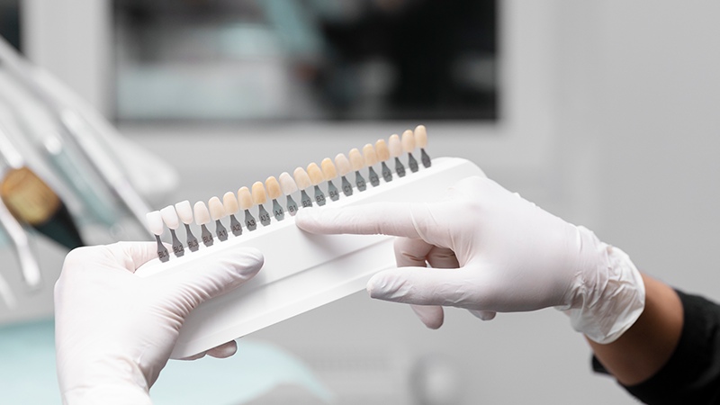 رنگ کامپوزیت