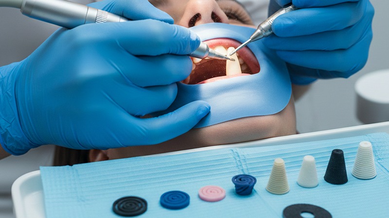 فینیشینگ و پالیشینگ کامپوزیت دندان