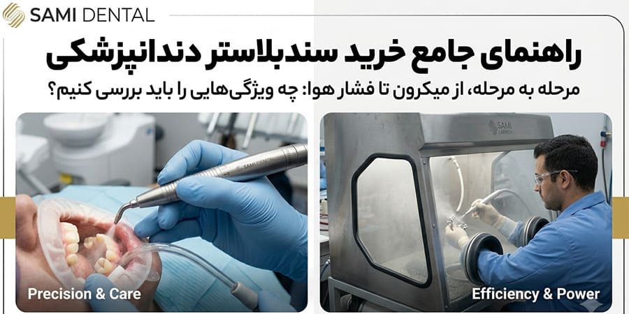 راهنمای خرید سندبلاستر