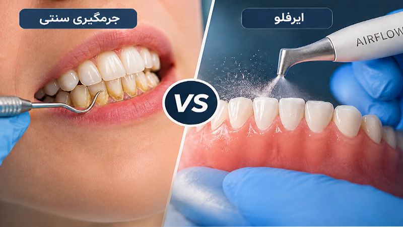 مقایسه ایرفلو و جرمگیری