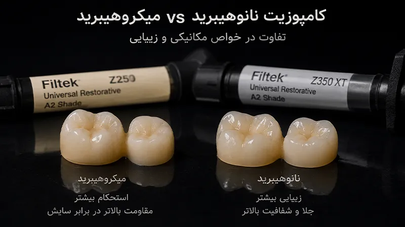 تفاوت خواص مکانیکی و زیبایی کامپوزیت نانوهیبرید و میکروهیبرید