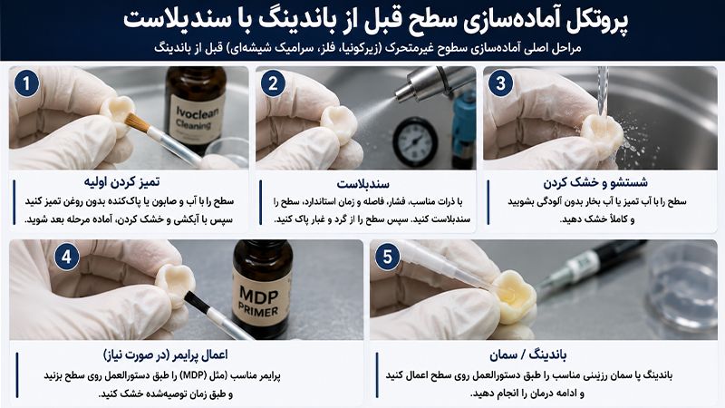 پروتکل آماده سازی سطح قبل از باندینگ با سندبلاست