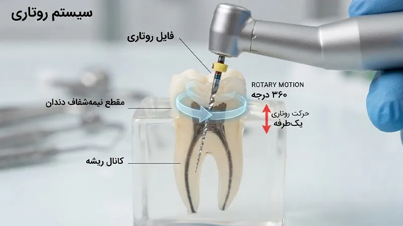 سیستم روتاری چیست ،نحوه عملکرد