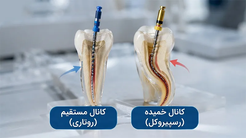 مقایسه سیستم روتاری و رسیپروکال در کانال مستقیم و خمیده