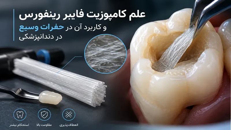 نقش کامپوزیت فایبر رینفورس در تقویت ترمیم‌های وسیع