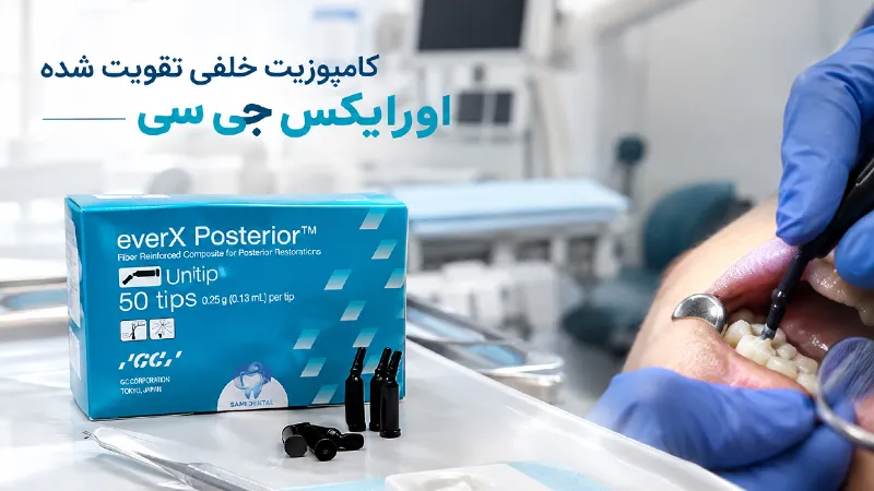 کامپوزیت خلفی اورایکس جی سی