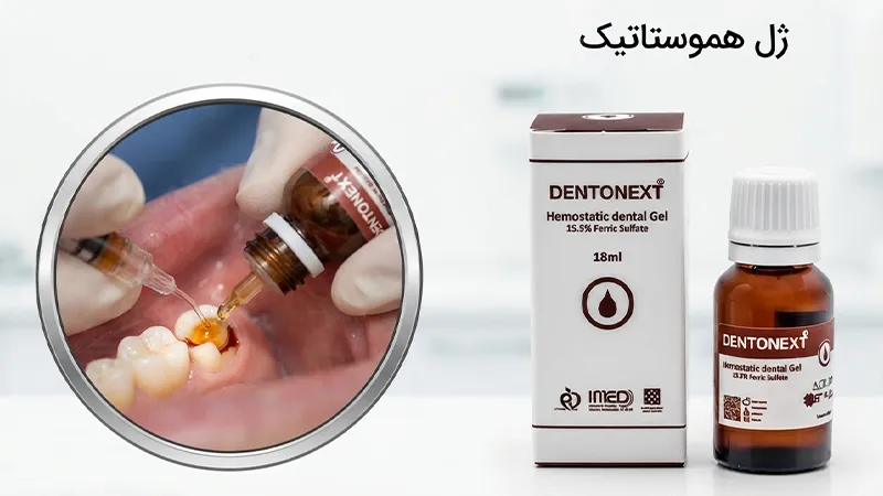 سولفات فریک دندان پزشکی