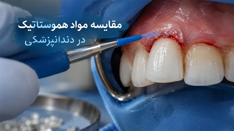 مقایسه‌ی مواد هموستاتیک دندانپزشکی
