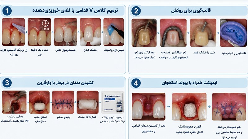 مواد هموستاتیک در دندانپزشکی